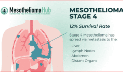 Malignant Pleural Mesothelioma: Survival Rate Overview